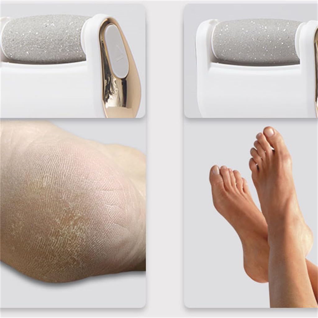 YMGSCC Rechargeable Calluses Remover Foot Grinder Electric Foot Trimmer